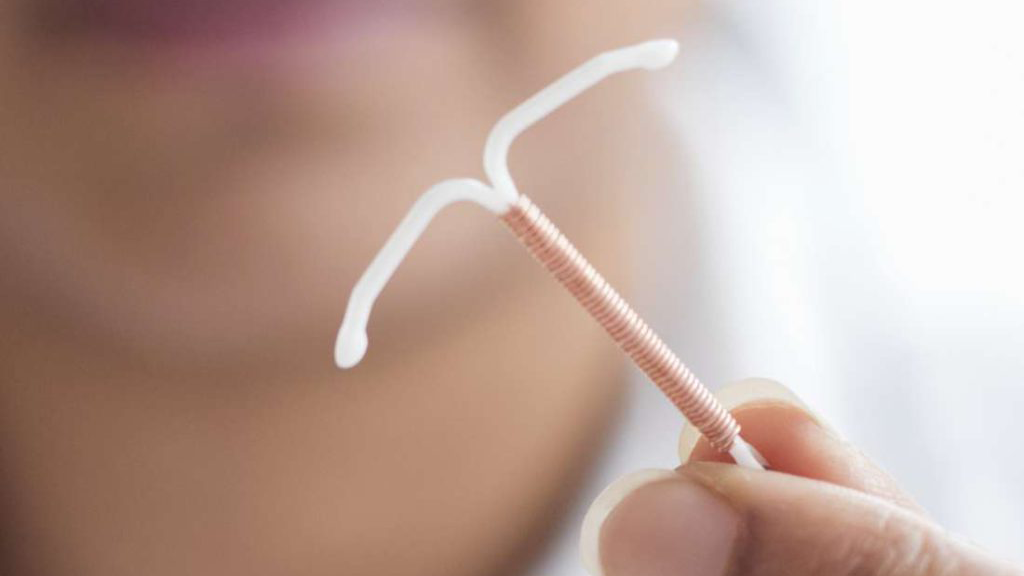 Copper Iud Vs Mirena Pros And Cons The Lowdown 1516