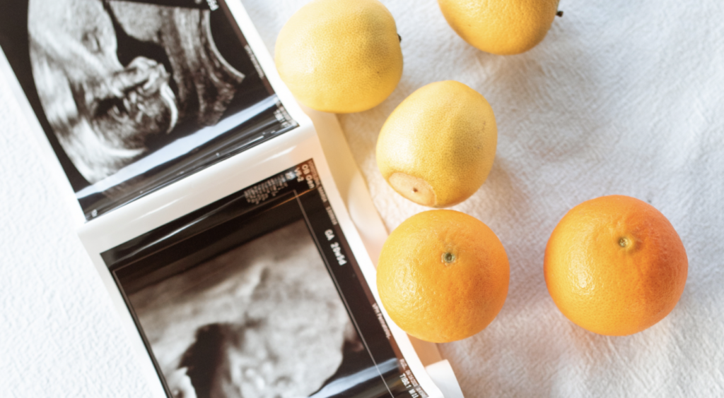 Baby scan and lemons